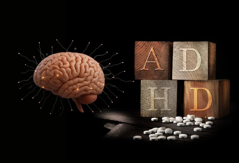 ADHD Style Brains